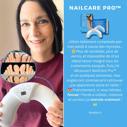 Palamot™ Nailcare Elimina i funghi delle unghie in 30 giorn