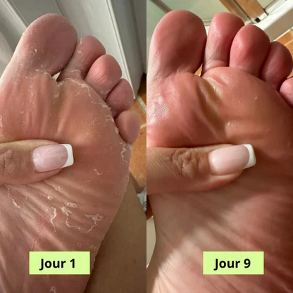 Nalé® Sapone Purificante Antimicotico